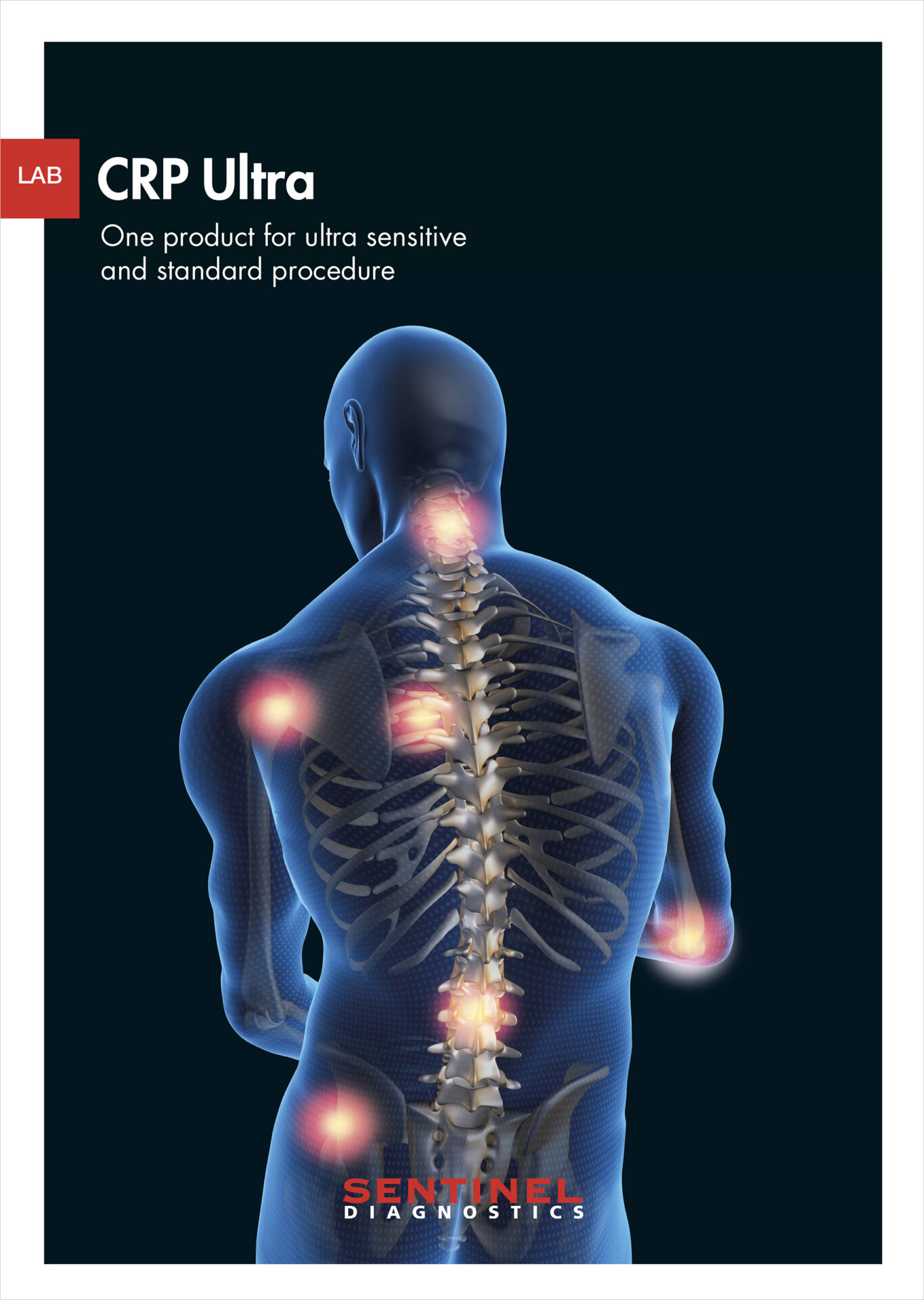 Sentinel Diagnostics - Scheda tecnica CRP Ultra
